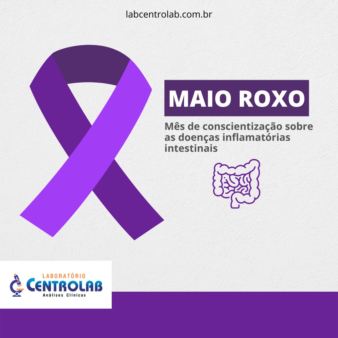 You are currently viewing Maio Roxo