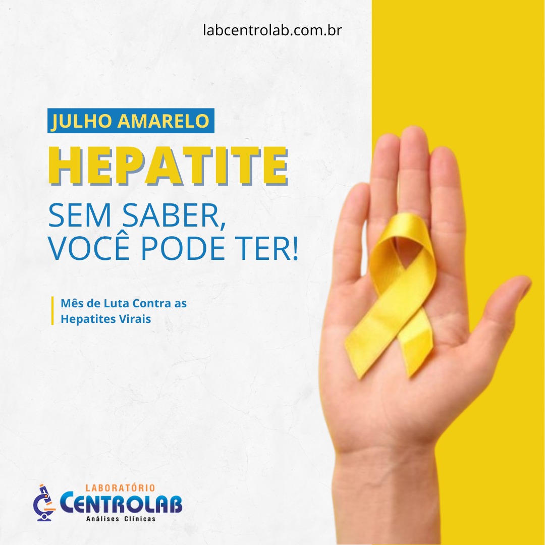 You are currently viewing JULHO AMARELO